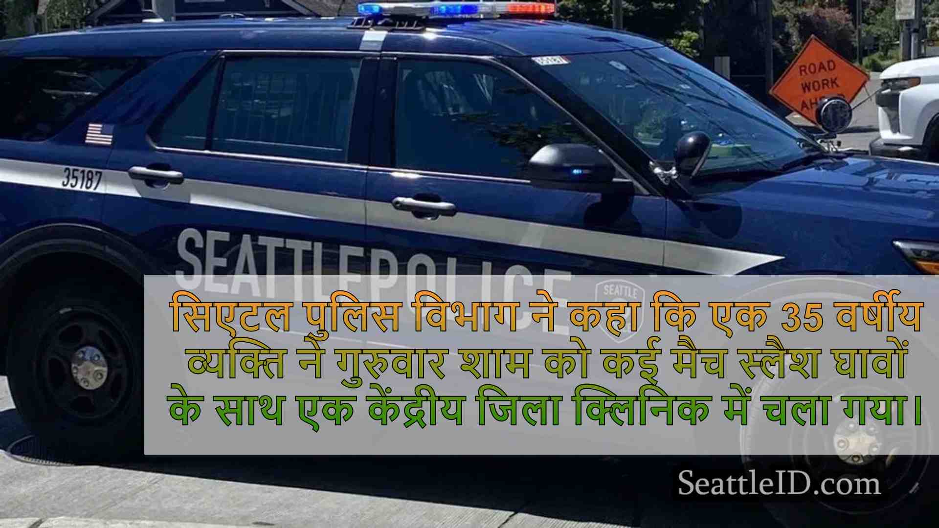 आदमी 'मल्टीपल मैच स्लैश घावों' के साथ