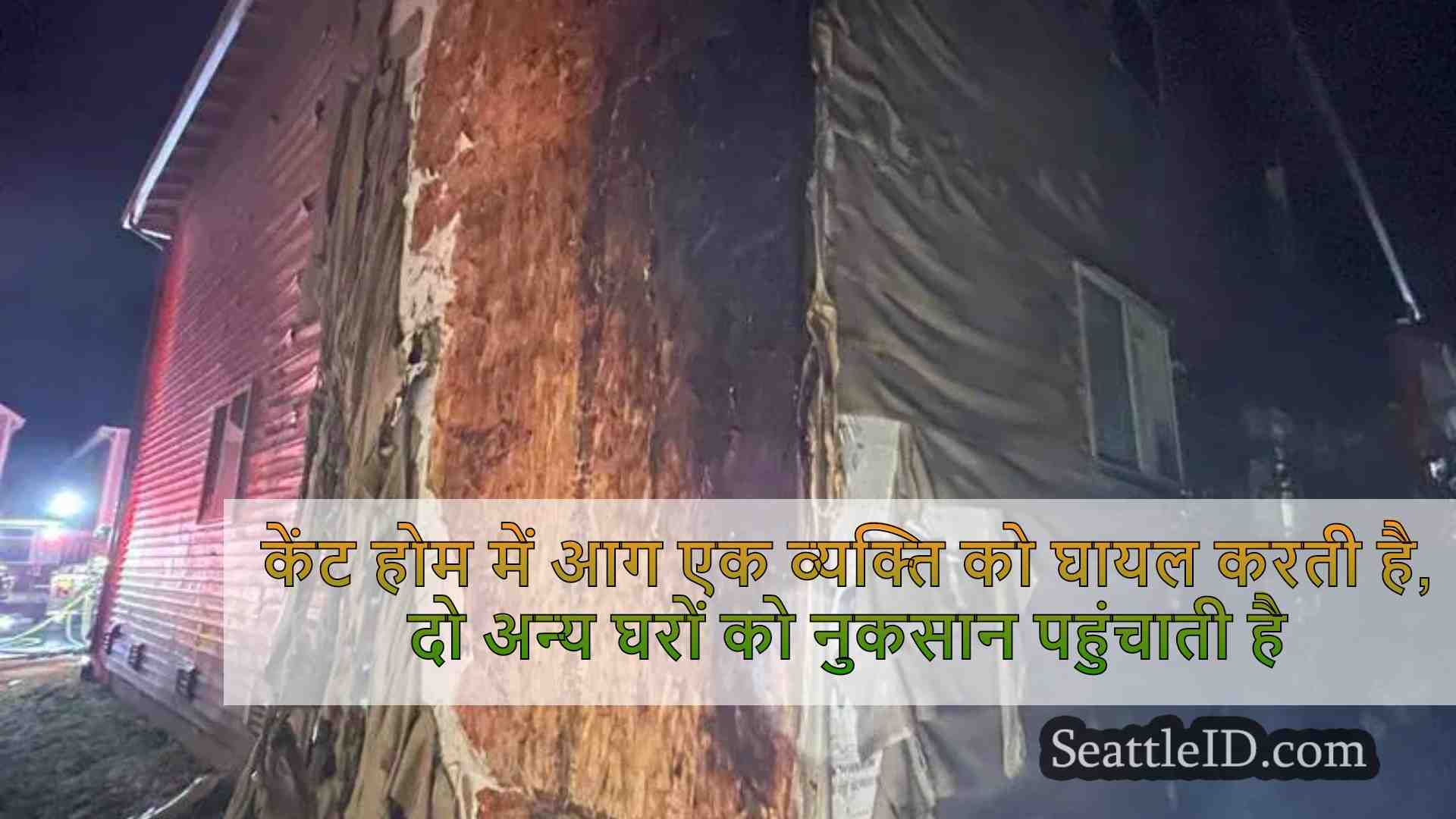 सिएटल समाचार SeattleID