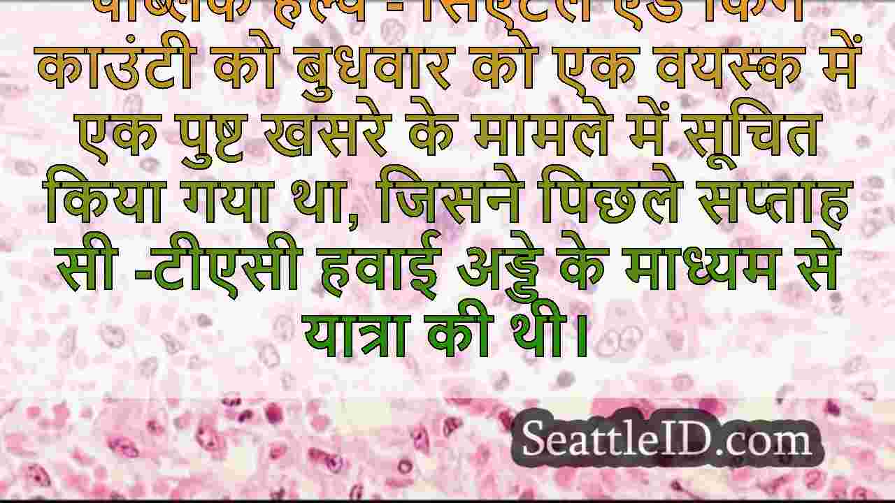 सिएटल समाचार SeattleID