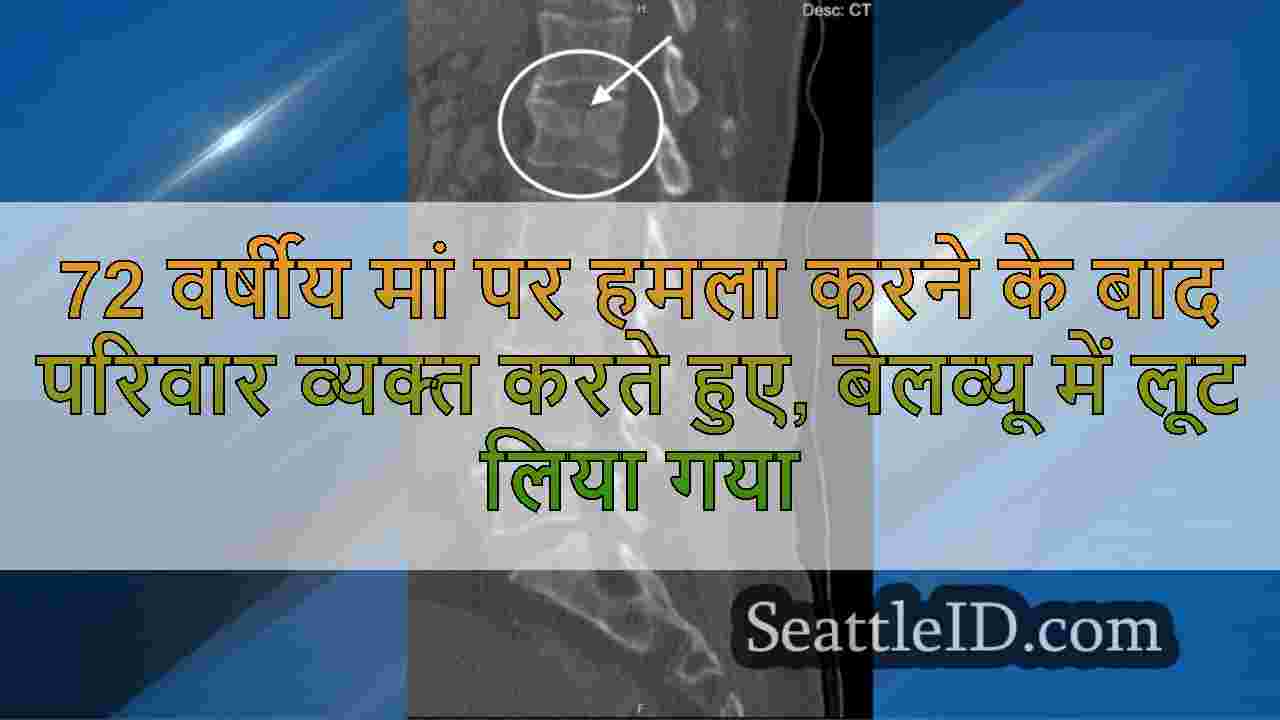 72 वर्षीय मां पर हमला करने के बाद