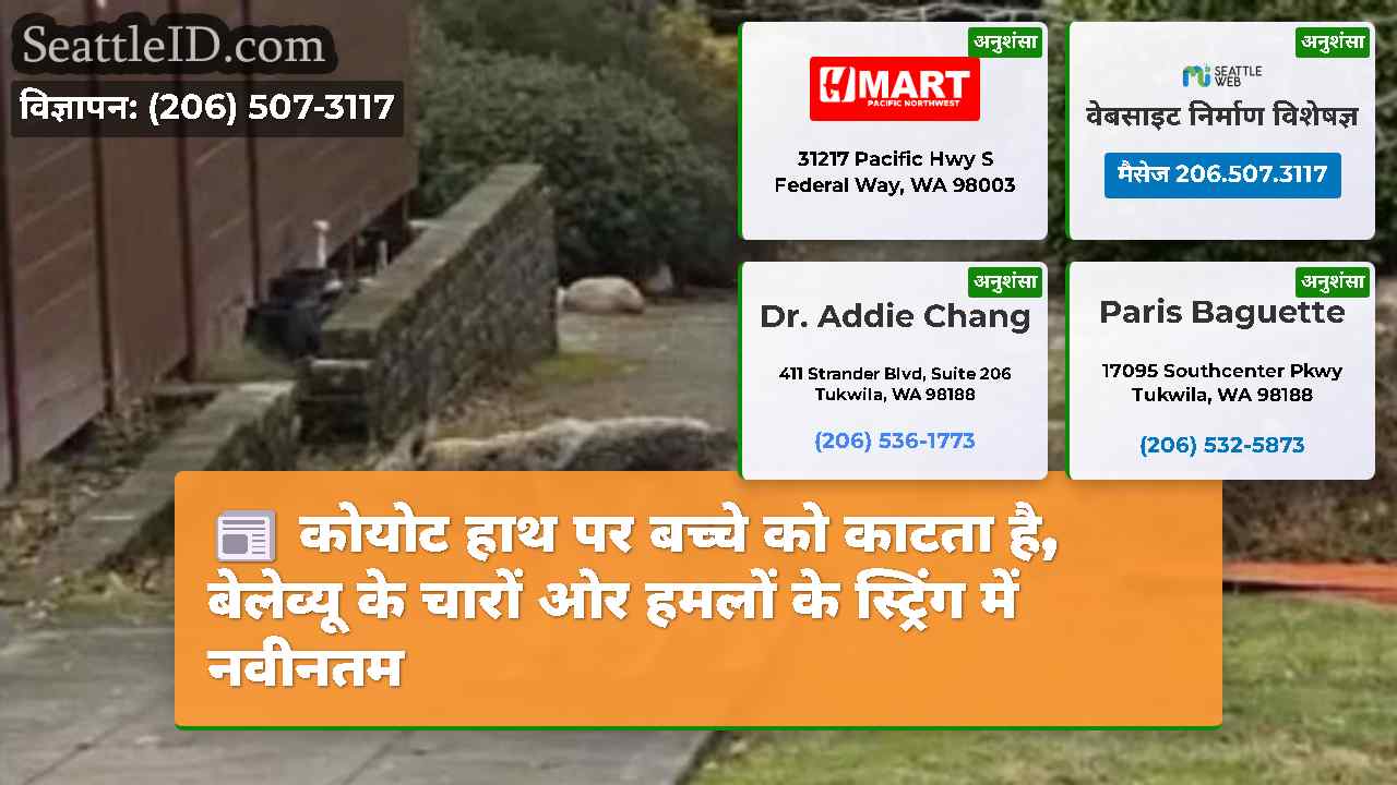 कोयोट हाथ पर बच्चे को काटता है, बेलेव्यू के चारों