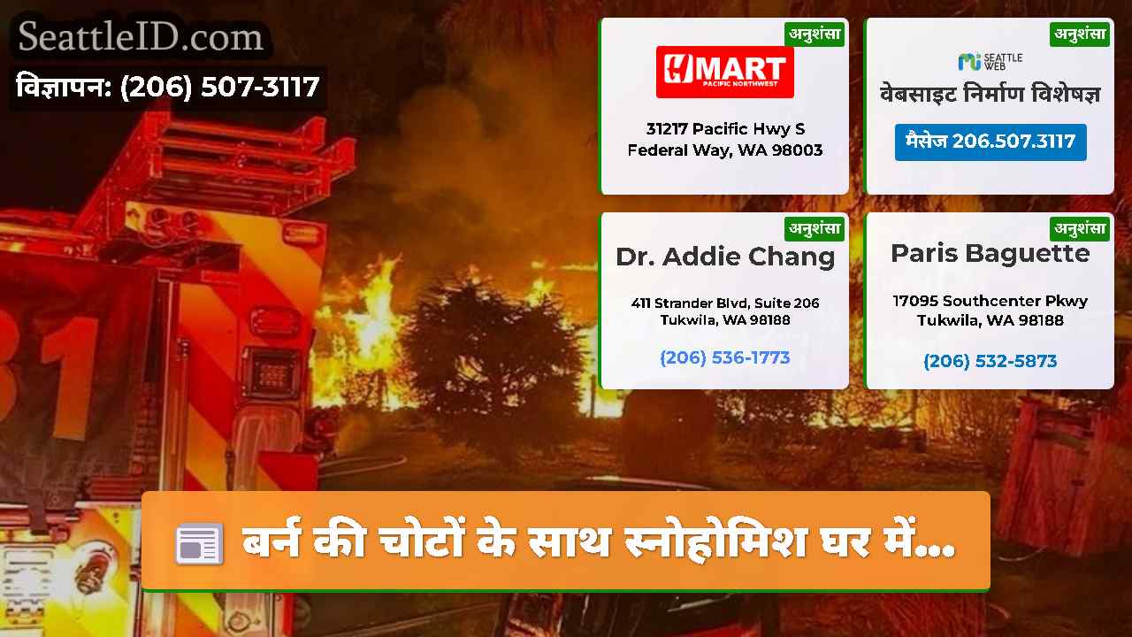बर्न की चोटों के साथ स्नोहोमिश घर में...