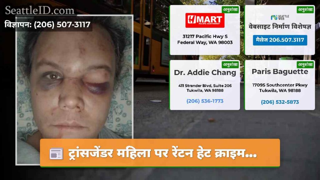 ट्रांसजेंडर महिला पर रेंटन हेट क्राइम...