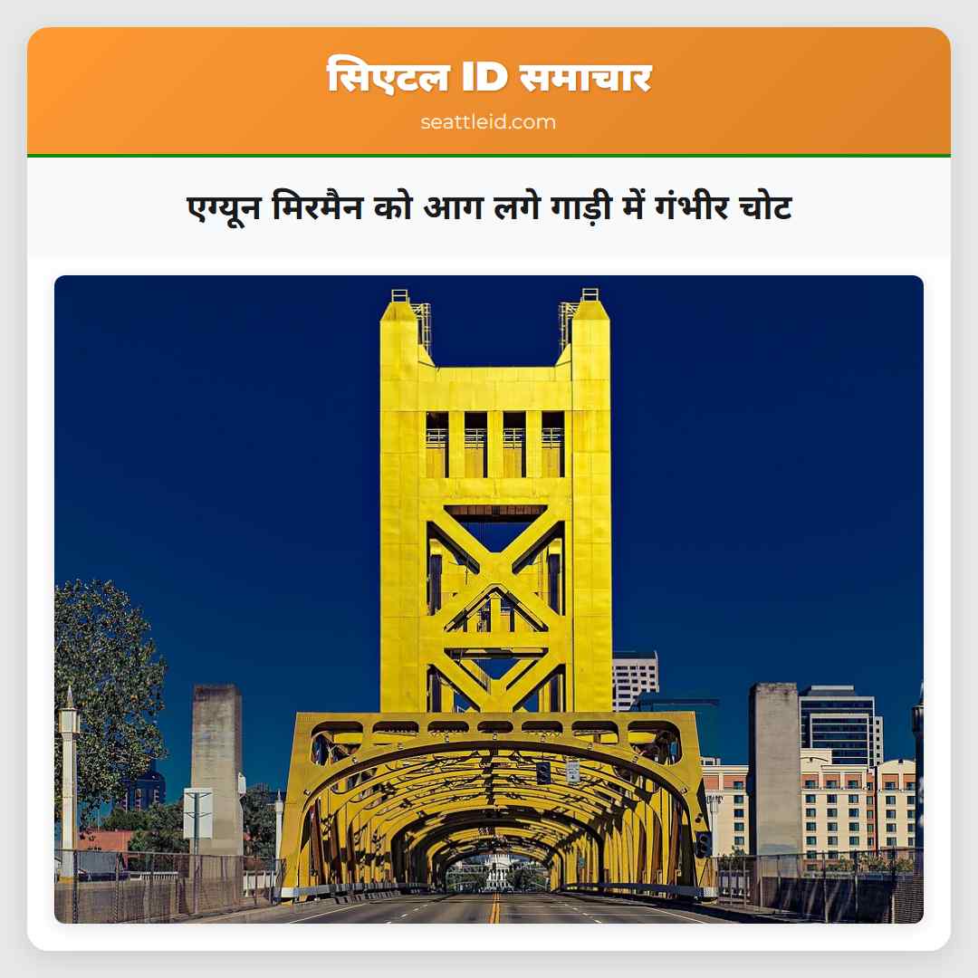 एग्यून मिरमैन को आग लगे गाड़ी में गंभीर चोट