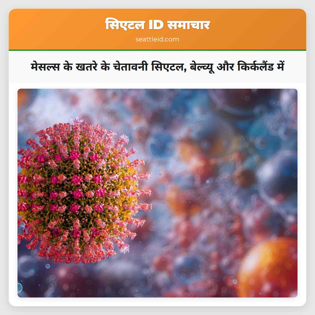 मेसल्स के खतरे के चेतावनी सिएटल, बेल्व्यू और