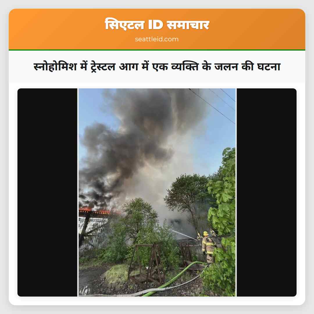 स्नोहोमिश में ट्रेस्टल आग में एक व्यक्ति के जलन