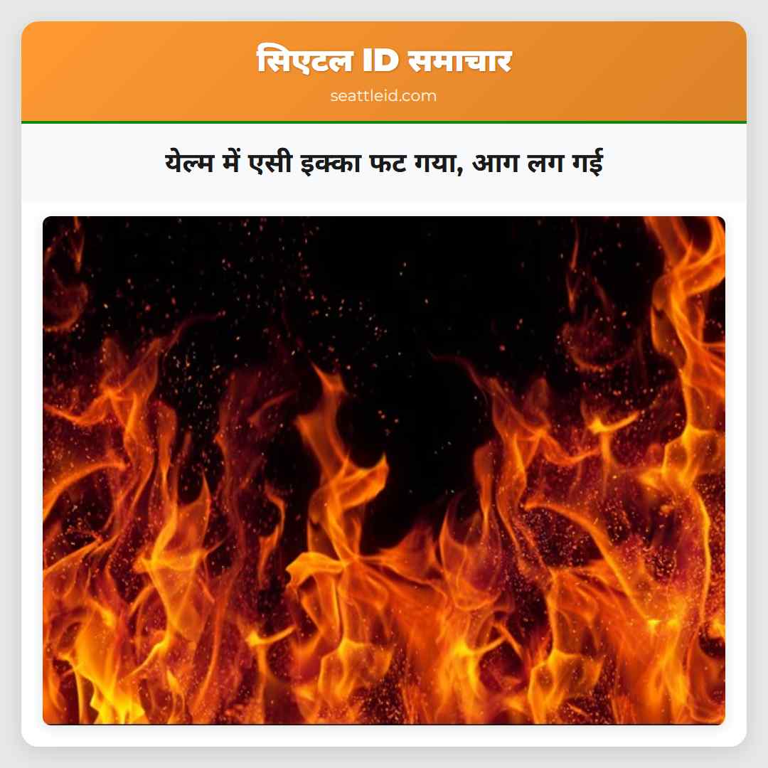 येल्म में एसी इक्का फट गया, आग लग गई